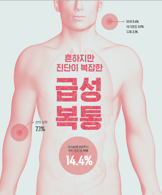 24시간 불 밝힌 권역응급의료센터 - 흔하지만 진단이 복잡한 급성 복통
